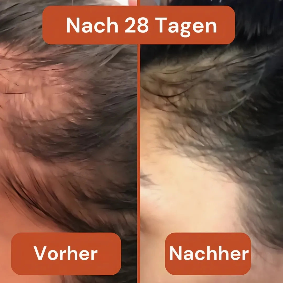 Kürbiskernöl Haar-Komplex